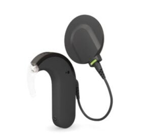 Lee más sobre el artículo 5 curiosidades del ‘oído biónico’ para personas con pérdida auditiva