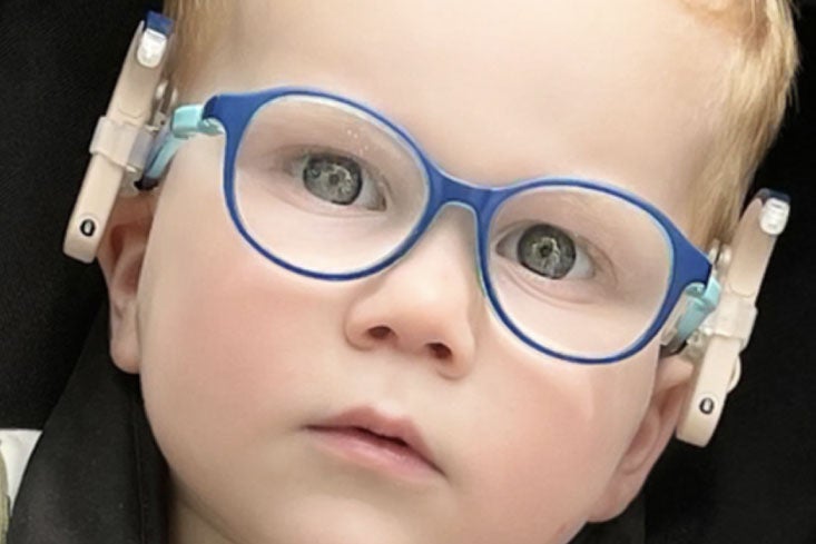 Opciones de uso para niños con gafas e implantes auditivos